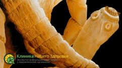 Половая система ленточных червей Строение размножение и развитие ленточных червей